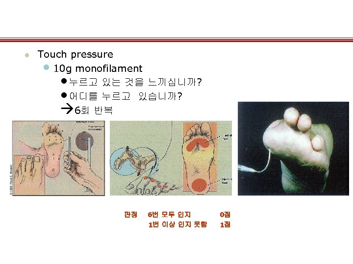 l Touch pressure • 10 g monofilament • 누르고 있는 것을 느끼십니까? • 어디를