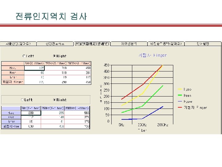 전류인지역치 검사 