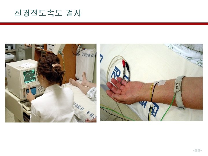 신경전도속도 검사 -59 - 