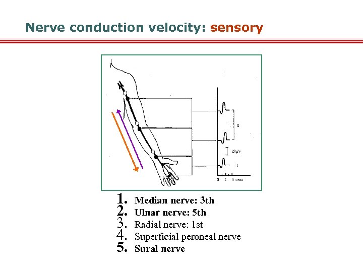 Nerve conduction velocity: sensory 1. 2. 3. 4. 5. Median nerve: 3 th Ulnar