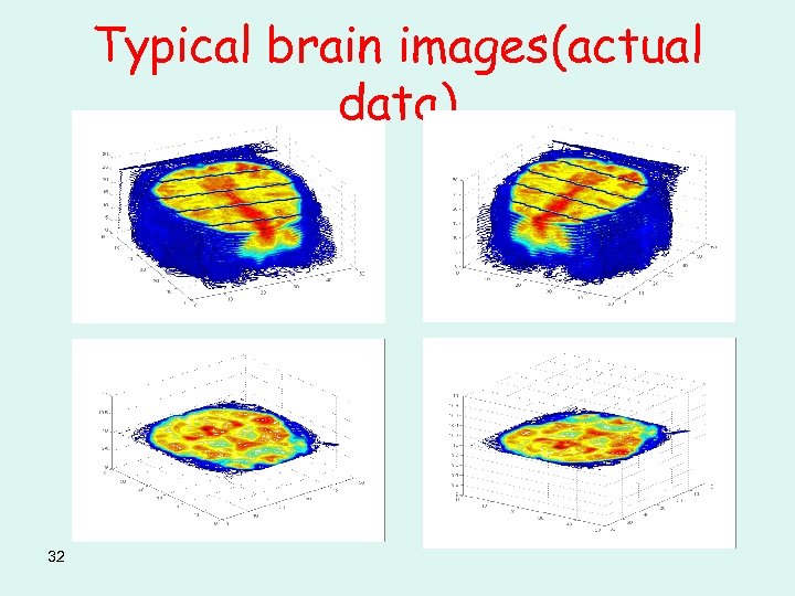 Typical brain images(actual data) 32 