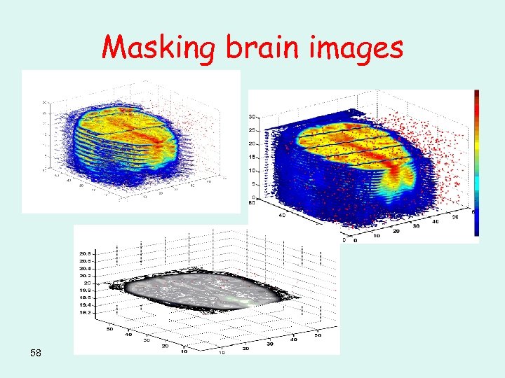 Masking brain images 58 