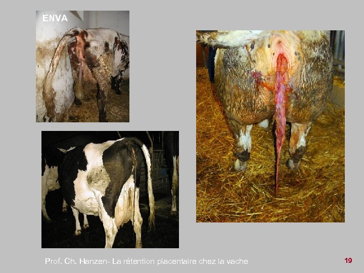 ENVA Prof. Ch. Hanzen- La rétention placentaire chez la vache 19 