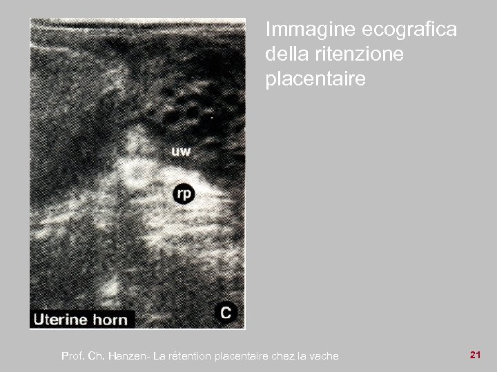Immagine ecografica della ritenzione placentaire Prof. Ch. Hanzen- La rétention placentaire chez la vache