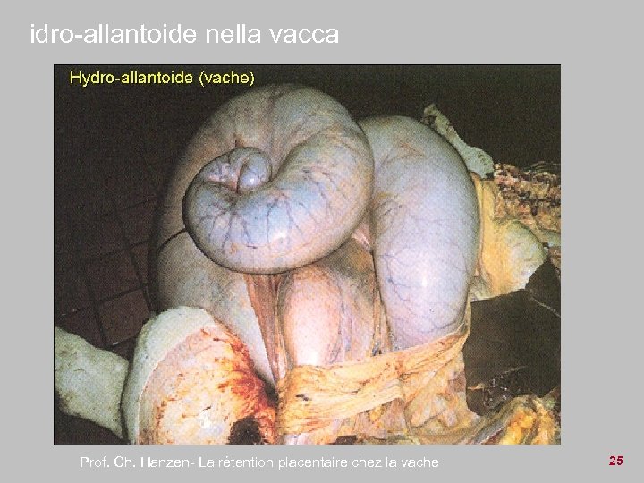 idro-allantoide nella vacca Prof. Ch. Hanzen- La rétention placentaire chez la vache 25 