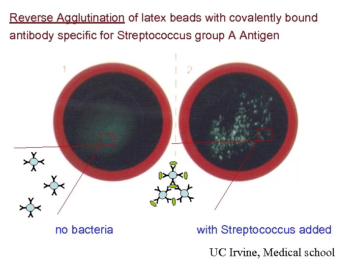 Reverse Agglutination of latex beads with covalently bound antibody specific for Streptococcus group A
