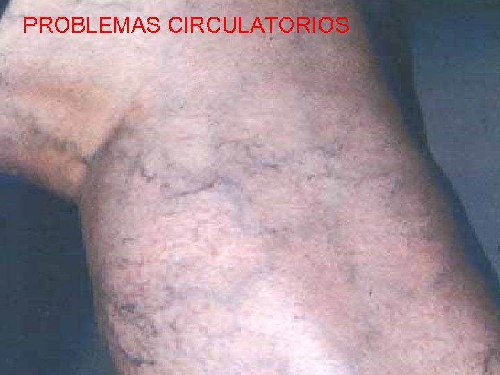 PROBLEMAS CIRCULATORIOS 