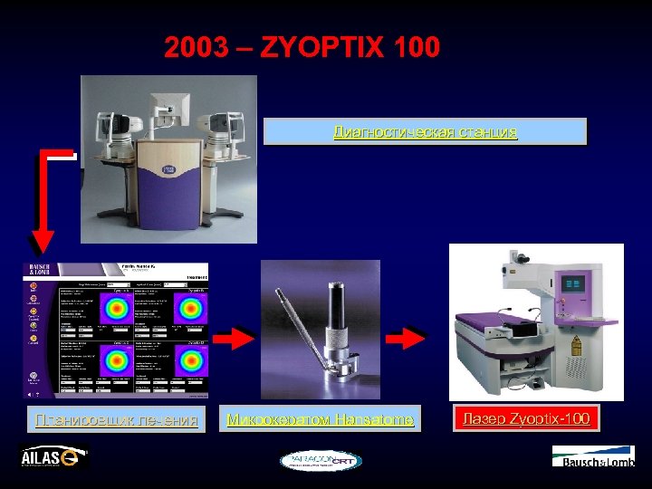 2003 – ZYOPTIX 100 Диагностическая станция Планировщик лечения Микрокератом Hansatome Лазер Zyoptix-100 
