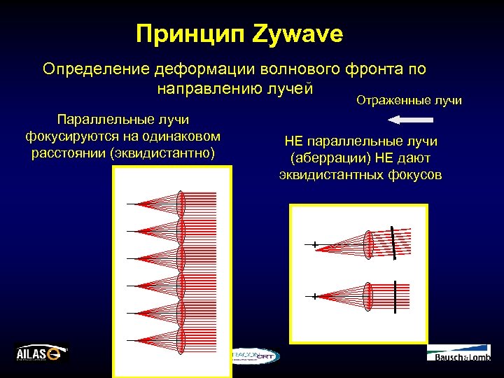 Принцип Zywave Определение деформации волнового фронта по направлению лучей Отраженные лучи Параллельные лучи фокусируются