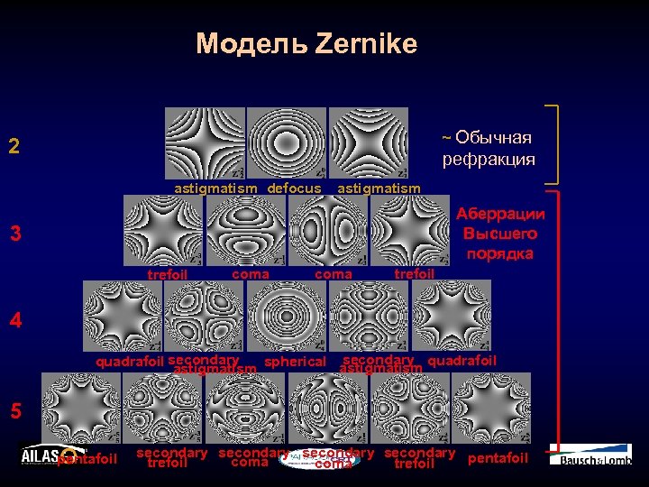 Модель Zernike ~ Обычная 2 рефракция astigmatism defocus astigmatism Аберрации Высшего порядка 3 trefoil