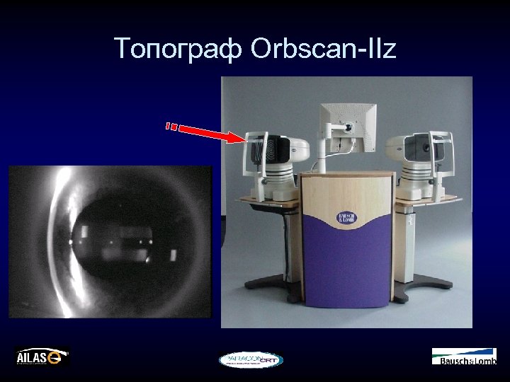 Топограф Orbscan-IIz 