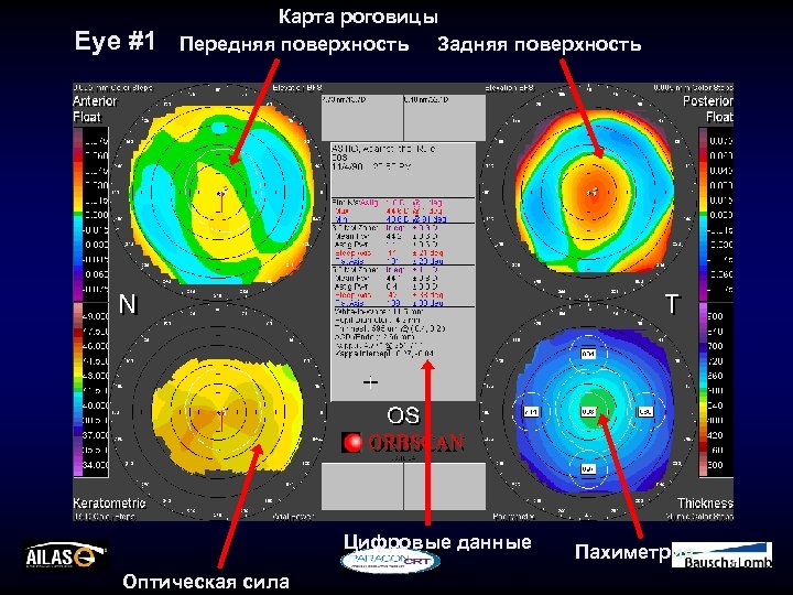 Eye #1 Карта роговицы Передняя поверхность Задняя поверхность Цифровые данные Оптическая сила Пахиметрия 