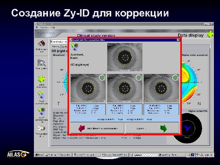 Создание Zy-ID для коррекции 