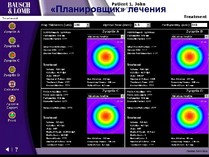  «Планировщик» лечения Zyoptix 100 – «планировщик» Zyoptix Diagnostic Workstation Next Generation through Software