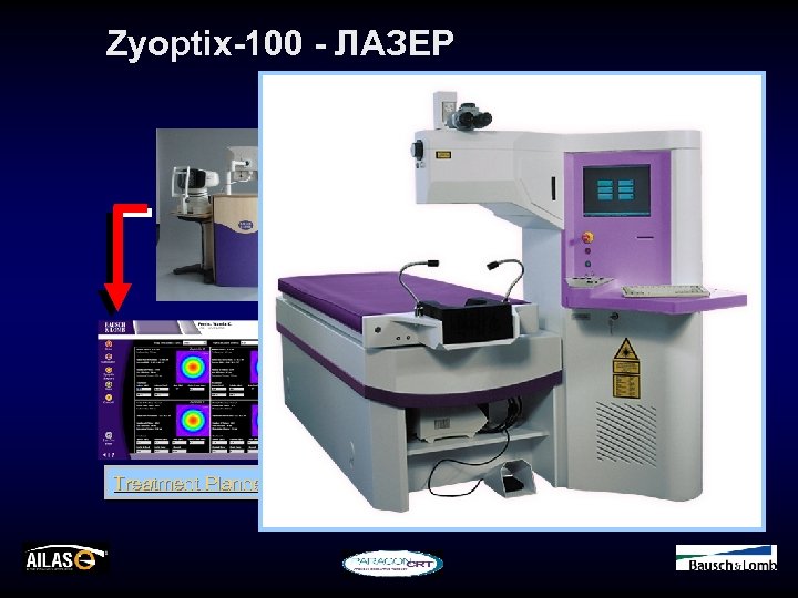 Zyoptix-100 - ЛАЗЕР Zyoptix Diagnostic Workstation Next Generation through Software Upgrade Treatment Planner Hansatome