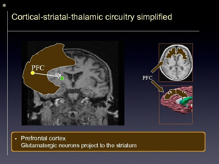 * Cortical-striatal-thalamic circuitry simplified PFC Glu § Prefrontal cortex Glutamatergic neurons project to the