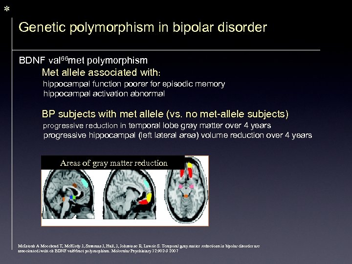 * Genetic polymorphism in bipolar disorder BDNF val 66 met polymorphism Met allele associated