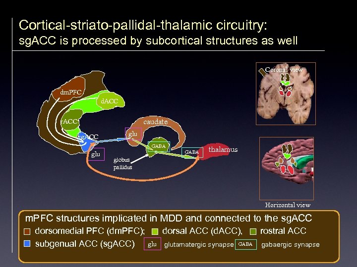 Cortical-striato-pallidal-thalamic circuitry: sg. ACC is processed by subcortical structures as well Coronal view dm.