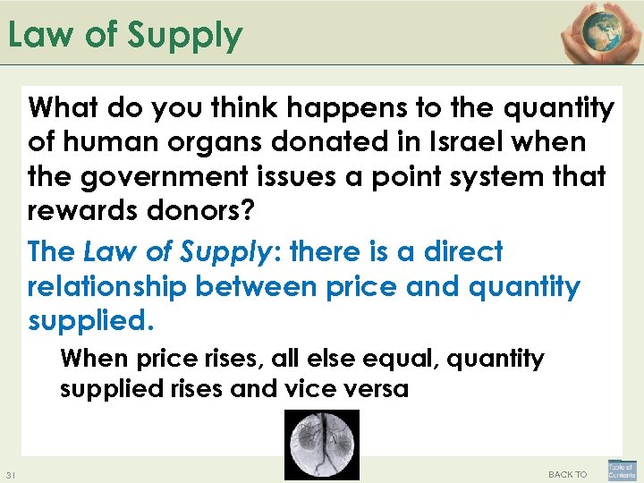 Law of Supply What do you think happens to the quantity of human organs