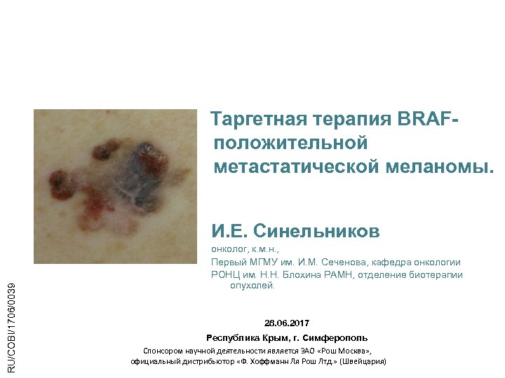 Таргетная терапия BRAFположительной метастатической меланомы. RU/COBI/1706/0039 И. Е. Синельников онколог, к. м. н. ,