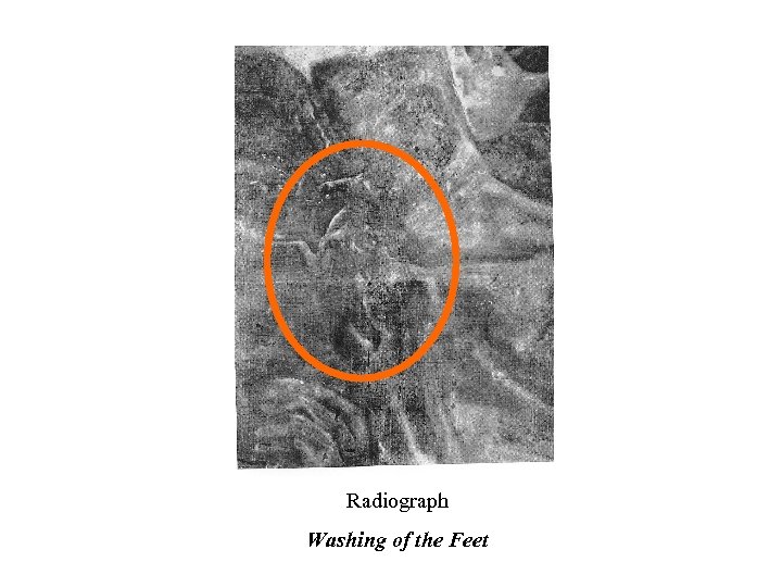 Radiograph Washing of the Feet 