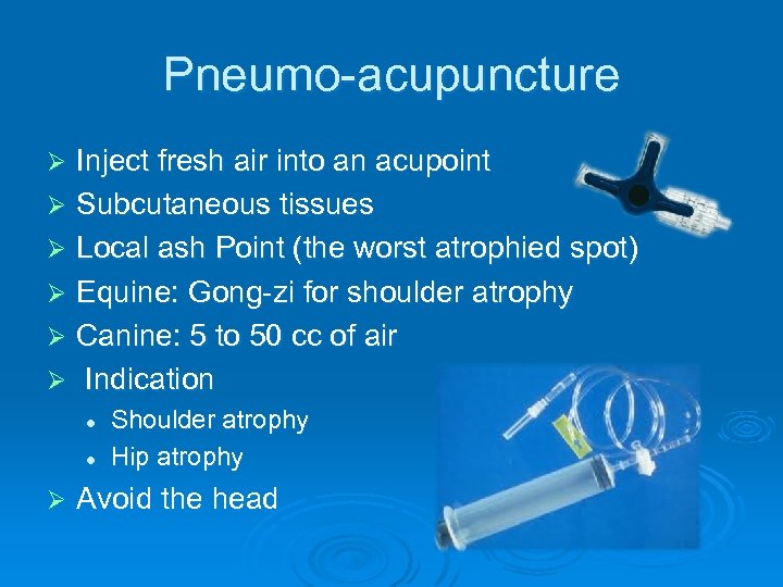 Pneumo-acupuncture Inject fresh air into an acupoint Ø Subcutaneous tissues Ø Local ash Point
