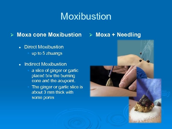 Moxibustion Ø Moxa cone Moxibustion l Direct Moxibustion • up to 5 zhuangs l