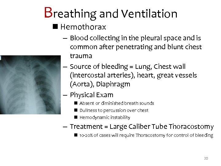 Breathing and Ventilation n Hemothorax – Blood collecting in the pleural space and is