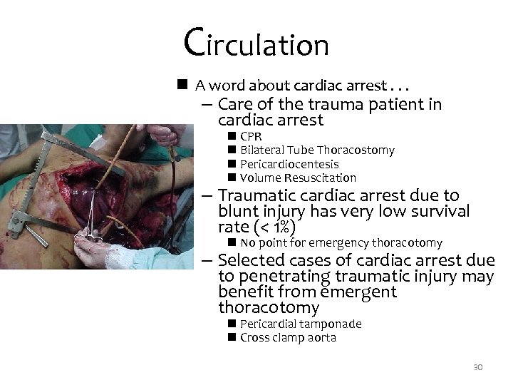 Circulation n A word about cardiac arrest. . . – Care of the trauma