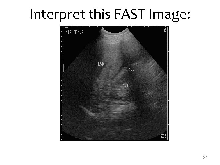 Interpret this FAST Image: 57 