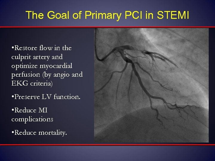 The Goal of Primary PCI in STEMI • Restore flow in the culprit artery