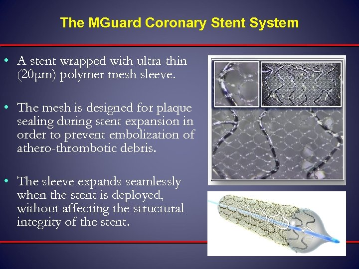 The MGuard Coronary Stent System • A stent wrapped with ultra-thin (20μm) polymer mesh