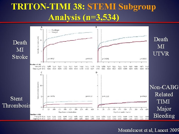 TRITON-TIMI 38: STEMI Subgroup Analysis (n=3, 534) Death MI Stroke Stent Thrombosis Death MI