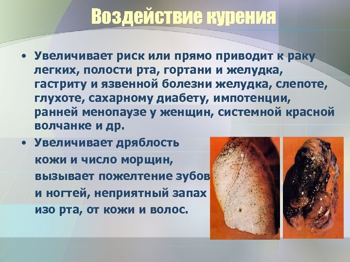 Воздействие курения • Увеличивает риск или прямо приводит к раку легких, полости рта, гортани