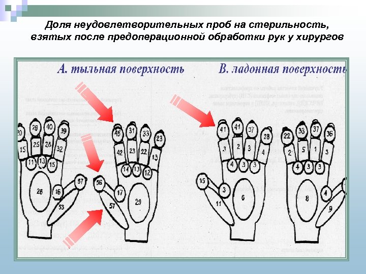 Доля неудовлетворительных проб на стерильность, взятых после предоперационной обработки рук у хирургов 