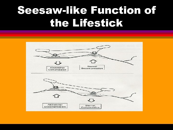 Seesaw-like Function of the Lifestick 