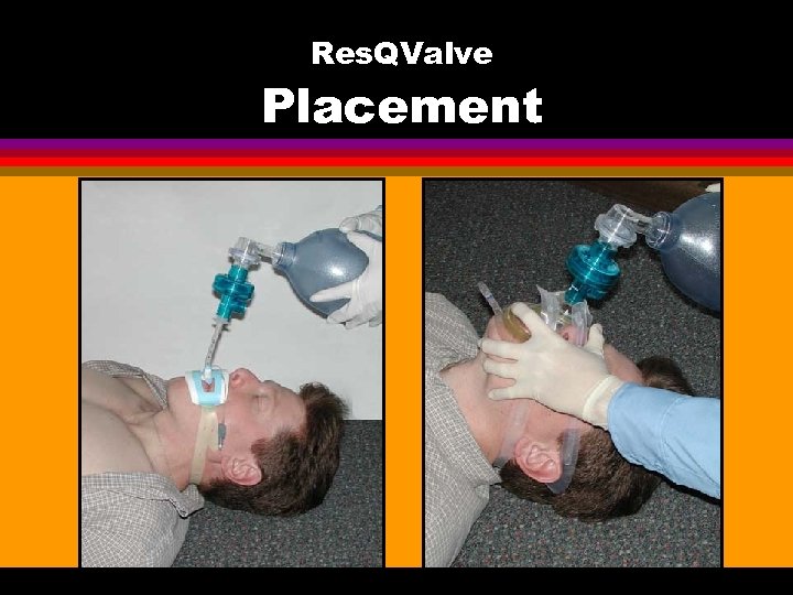 Res. QValve Placement 
