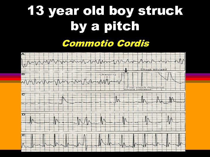 13 year old boy struck by a pitch Commotio Cordis 