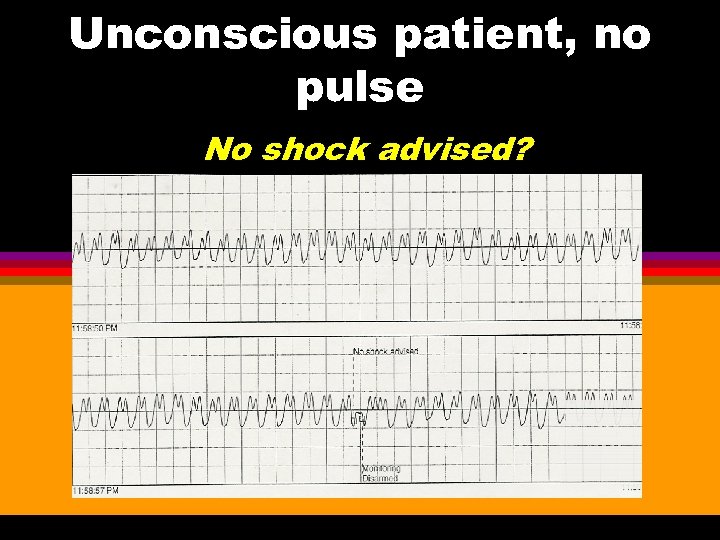 Unconscious patient, no pulse No shock advised? 