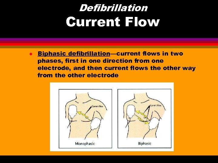 Defibrillation Current Flow l Biphasic defibrillation—current flows in two phases, first in one direction