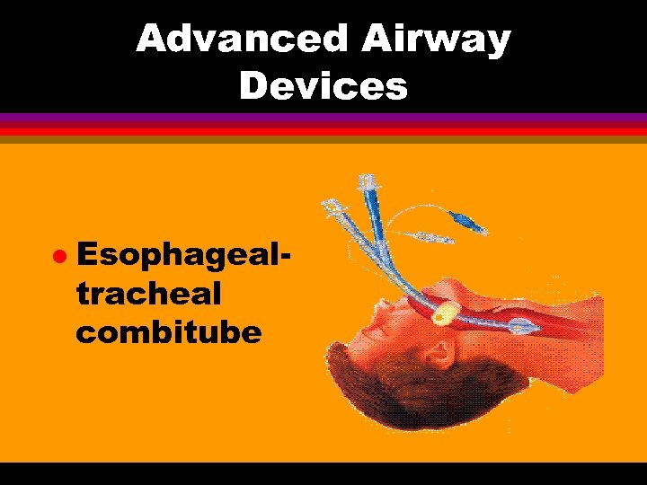 Advanced Airway Devices l Esophagealtracheal combitube 