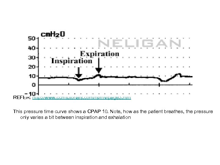 REFER: http: //www. ccmtutorials. com/rs/mv/page 3. htm This pressure time curve shows a CPAP