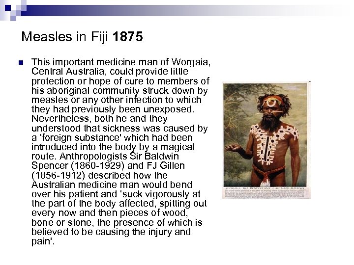 Measles in Fiji 1875 n This important medicine man of Worgaia, Central Australia, could