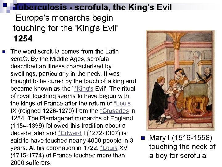 Tuberculosis - scrofula, the King's Evil Europe's monarchs begin touching for the 'King's Evil'