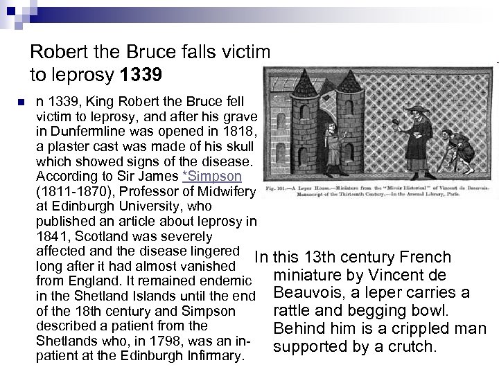 Robert the Bruce falls victim to leprosy 1339 n n 1339, King Robert the