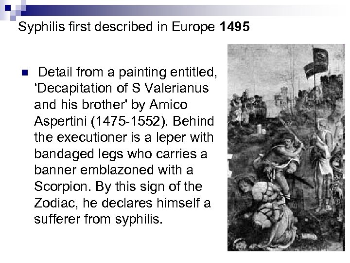 Syphilis first described in Europe 1495 n Detail from a painting entitled, ‘Decapitation of