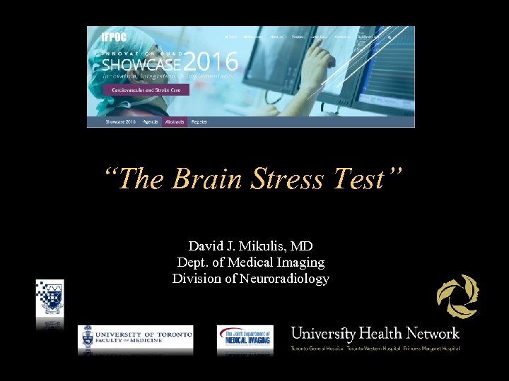 “The Brain Stress Test” David J. Mikulis, MD Dept. of Medical Imaging Division of