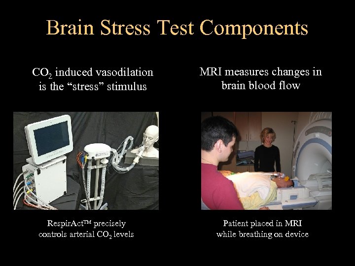 Brain Stress Test Components CO 2 induced vasodilation is the “stress” stimulus Respir. Act.