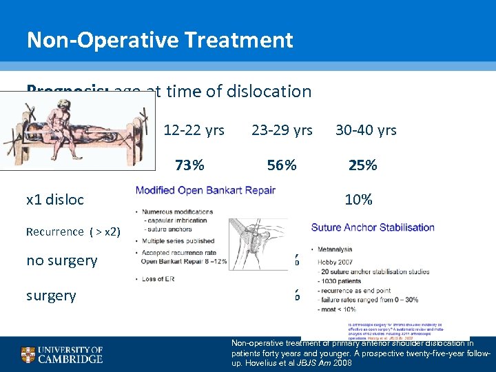 Non-Operative Treatment Prognosis: age at time of dislocation 12 -22 yrs 23 -29 yrs