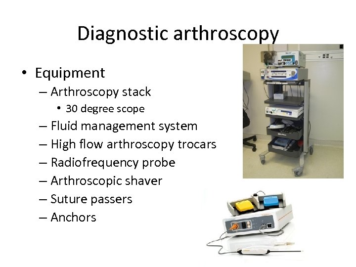 Diagnostic arthroscopy • Equipment – Arthroscopy stack • 30 degree scope – Fluid management
